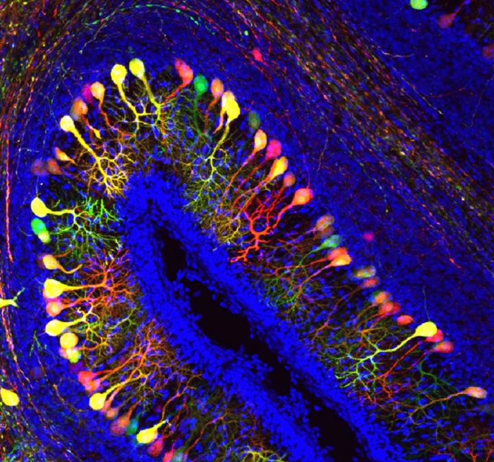 Purkinje Cells