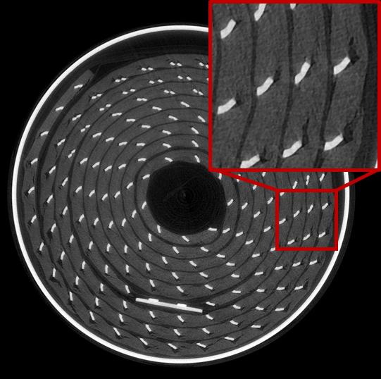 Xrays