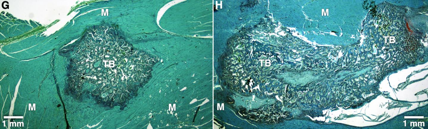 A Chimeric Growth Factor Accelerates Bone Repair in Nonhuman Primates (1 of 2)