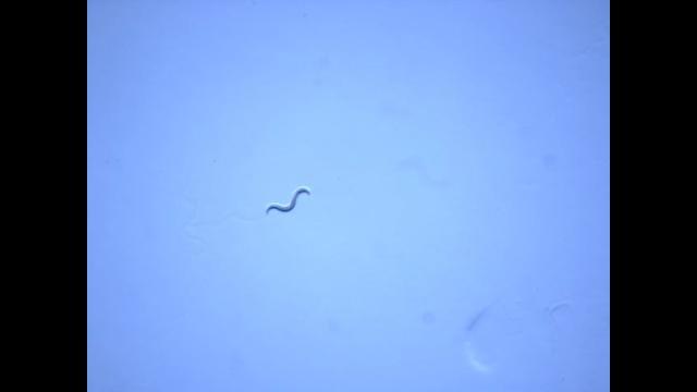 This Worm Learned to Associate the Pleasant Scent with Starvation