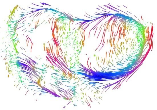 Cross Sectional View of the Heart 124 Days into Pregnancy