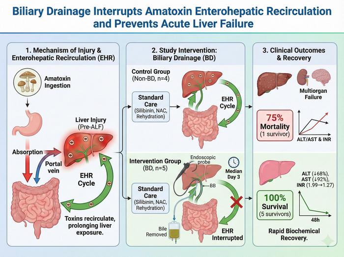 Bile Drainage Improves Survival in Amatoxin-induced Severe Liver Injury