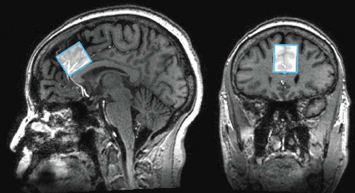MRIs (1 of 2)