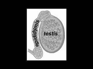 Defect in Sperm Protein Linked to Male Infertility (1 of 3)