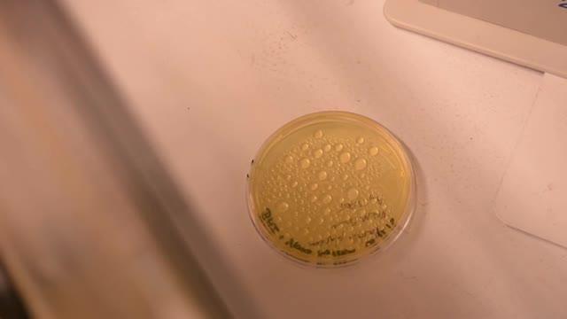 Yeast Linked to Asthma in Ecuador
