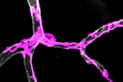 Pericytes, Part of the Blood-Brain Barrier
