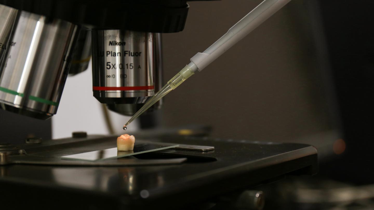 At Long Last, an Effective Remedy for Tooth Enamel Erosion (2 of 5)