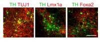 Dopaminergic Neurons