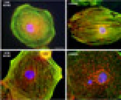 Stem Cells Offer Clues to Heart Disease