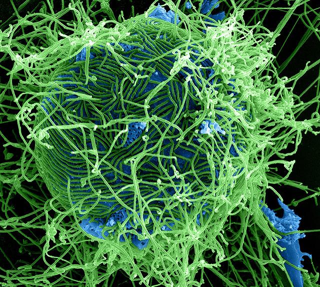 Colorized Scanning Electron Micrograph of Filamentous Ebola Virus Particles