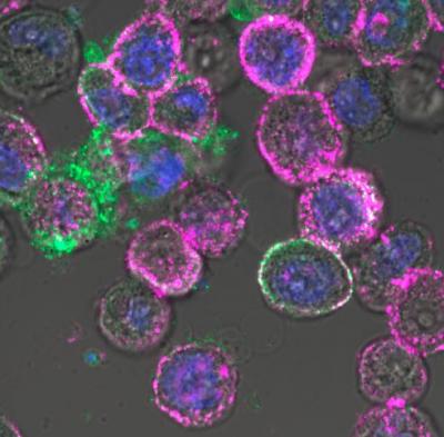Oncollytic Virus in Cancer Cells