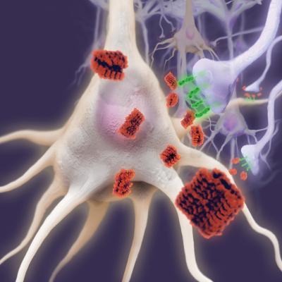 Research Relates Another Receptor to Alzheimer's (1 of 3)