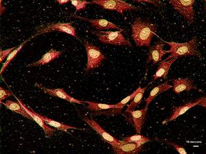 TGF-β signaling identified as a new therapeutic target for osteoporosis treatment