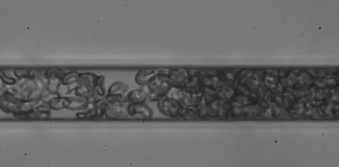 ‘Stiff’ cells