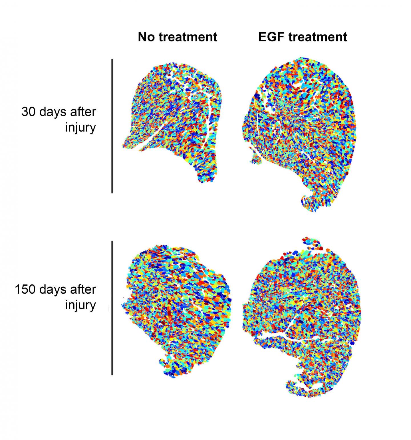 Discovery Points to Innovative New Way to Treat Duchenne Muscular Dystrophy