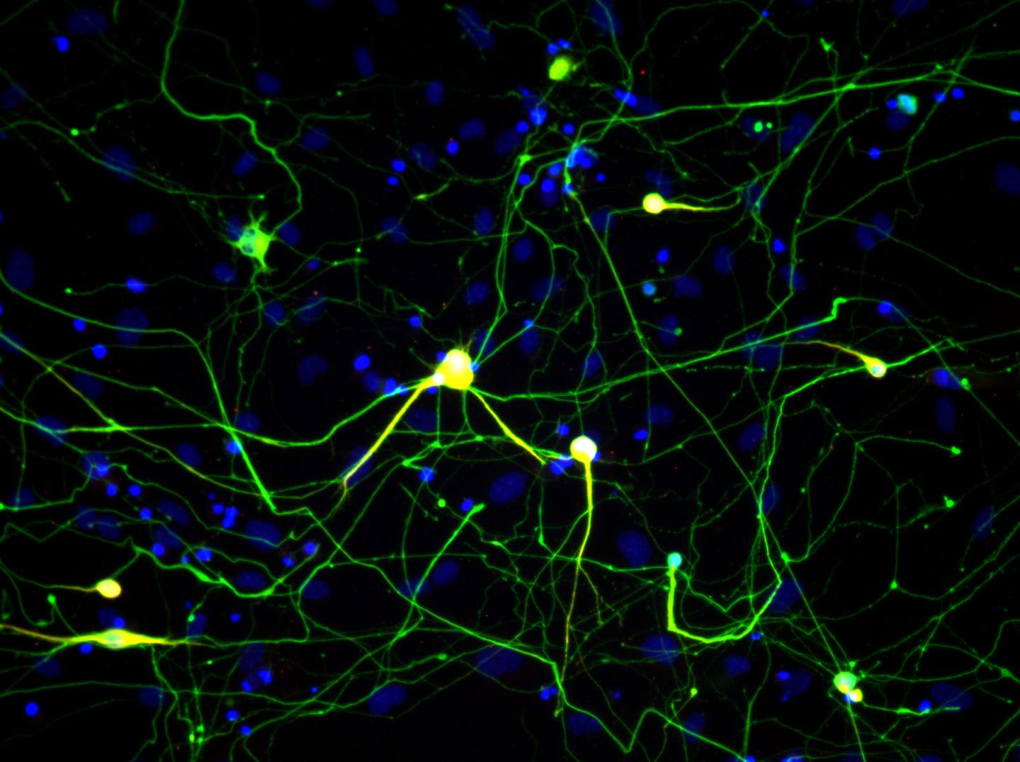 Neurons