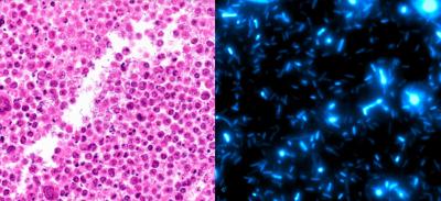 Bacteria Engineered as Trojan Horse for Cancer Immunotherapy