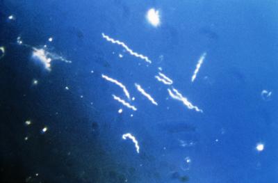 <i>Borrelia burgdorferi</i>