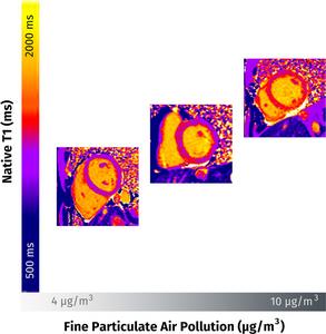 Exposure to Air Pollution May Cause Heart Damage