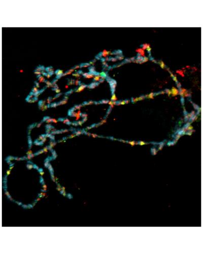Fly Polytene Chromosomes with Ataxin-7