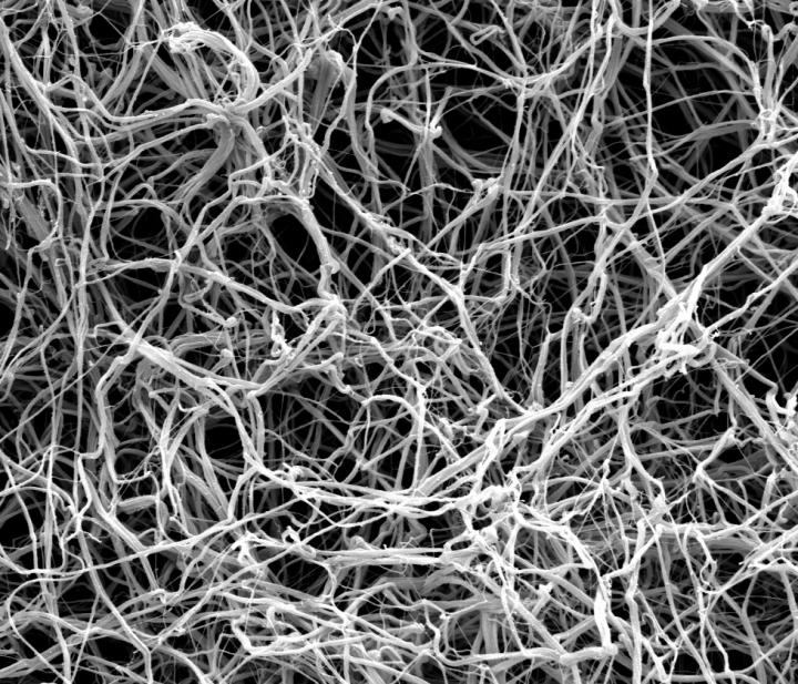 Fibrin fibres