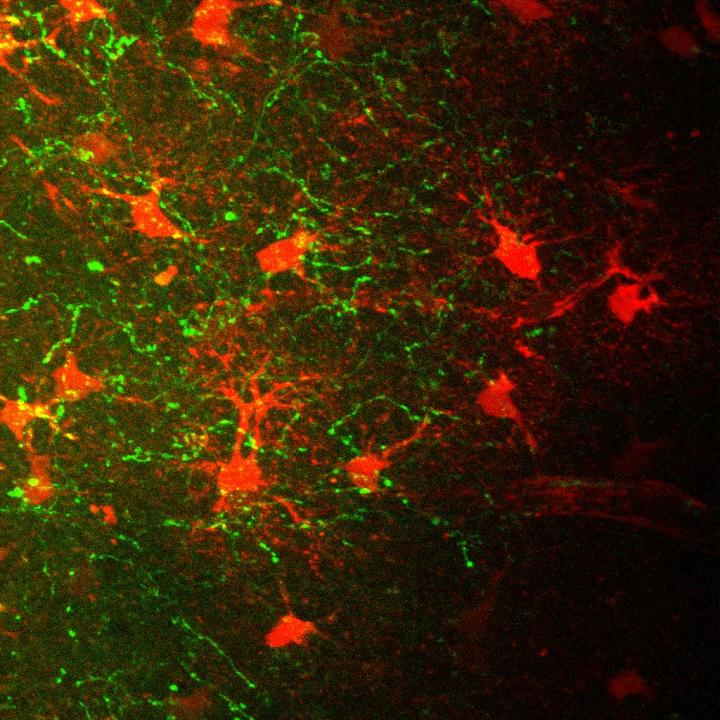 If the Brain is Exposed to Many New Sensations