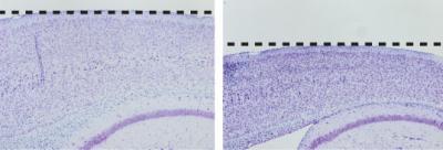 A New Mouse Model of Neurodegeneration