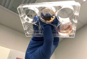 Illustration of organoids to test the influence of lead exposure to modern and archaic NOVA1