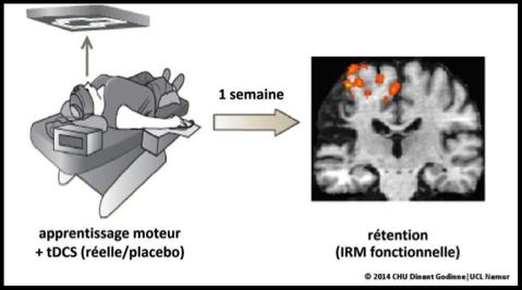 Brain Activity Recording