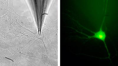 Fluorescence Microscopy