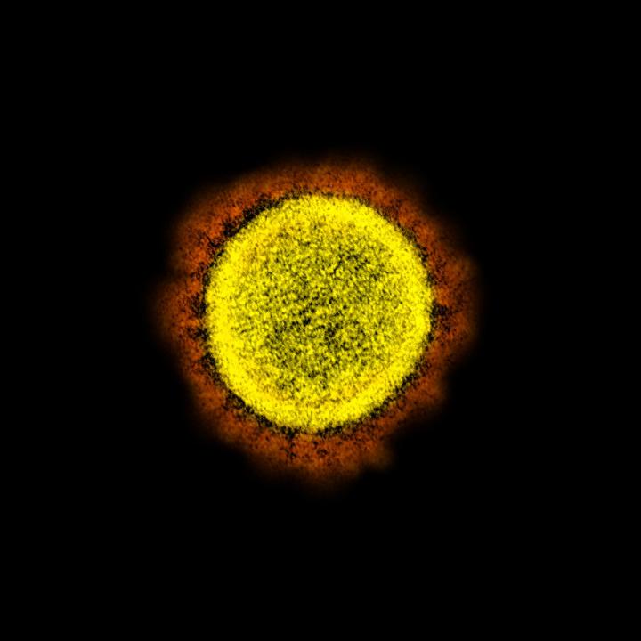 SARS-CoV-2 Virus Particles