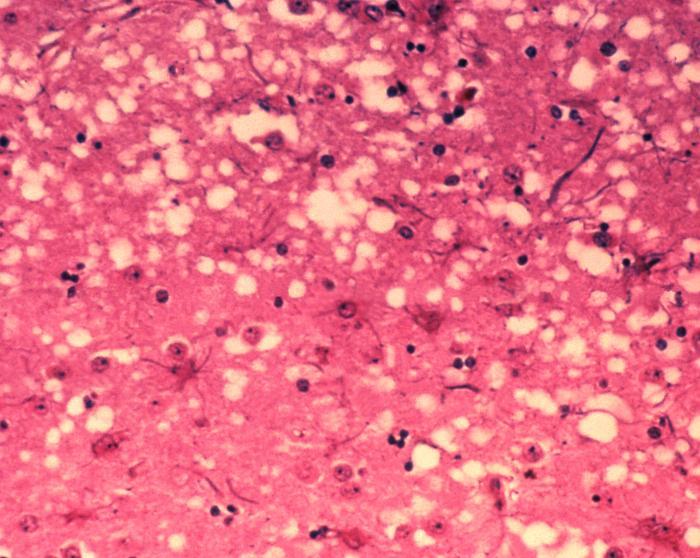 Prion Fibers
