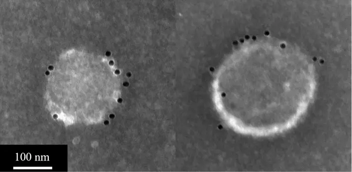Yeast‑derived universal flu vaccine could someday replace yearly injections