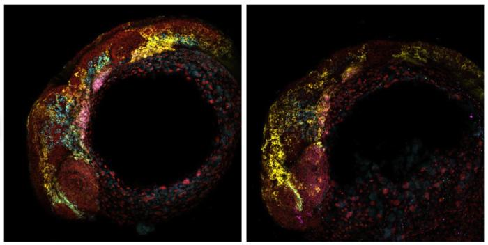 Gene Expression Changes in Zebrafish