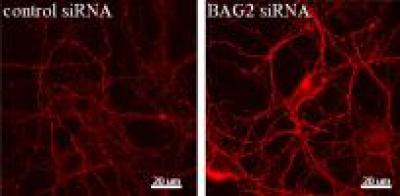 Images of Neurons in Culture