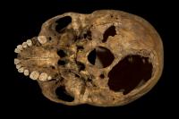 Base of the Skull