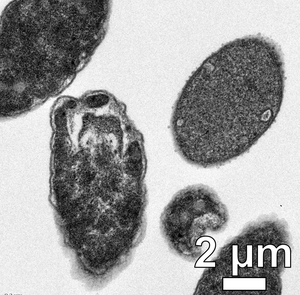 Escherichia coli bacteria after exposure to light-activated molecular drills