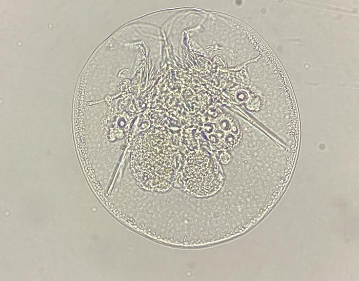 Testudinella patina, one of the rotifers found in the surveyed garden ponds