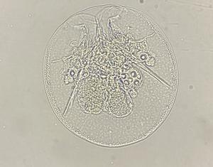 Testudinella patina, one of the rotifers found in the surveyed garden ponds