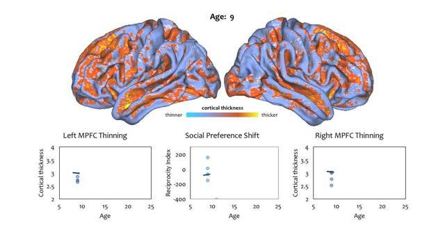 Cortical Thickness 