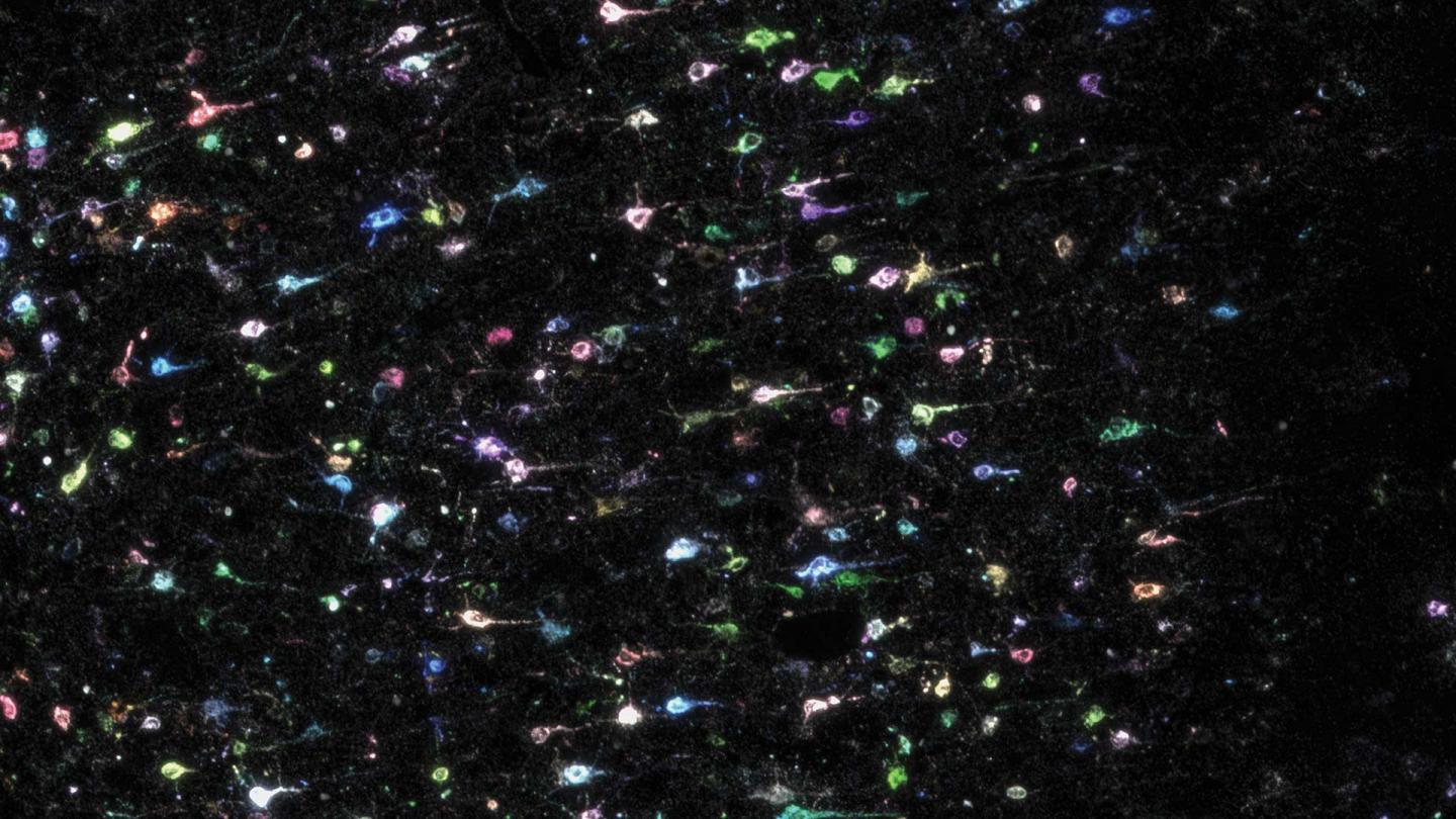BARseq2 Brain Cells