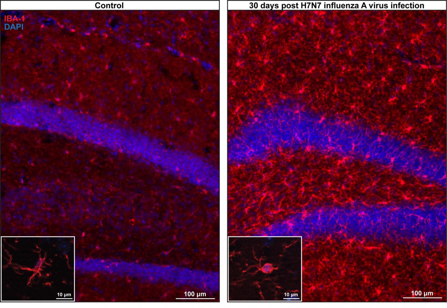 Microglia Density