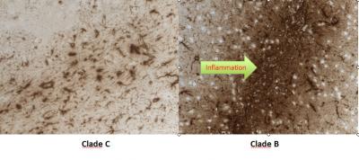 Clade B HIV vs. Clade C HIV