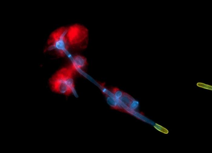 25-33_Leibniz-HKI_Candida-albicans.jpg