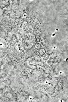 Three Dimensional Rendering of ZIKV-induced Membranes in hNPCs