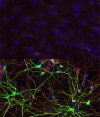 Skin Cells and Neurons