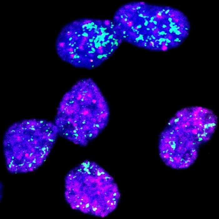 Neuroblastoma cells
