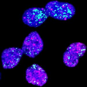 Neuroblastoma cells