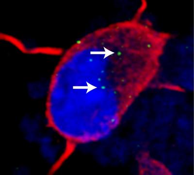 Toxic RNA Foci in C9ORF72 iPS Neurons (With Arrows)
