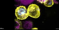 Cells Dying by Necroptosis